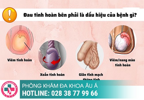  Bài Trắc Nghiệm Chẩn Đoán Triệu Chứng Đau Tinh Hoàn