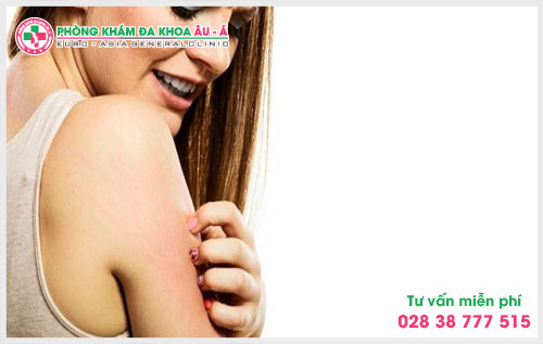  Bạn đã biết gì về bệnh chàm khô chưa?