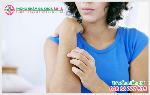  Những điều cần biết về bệnh ngứa nổi mề đay