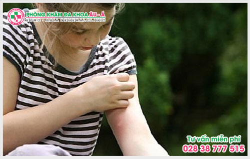  Những điều cần biết về triệu chứng của bệnh ngứa