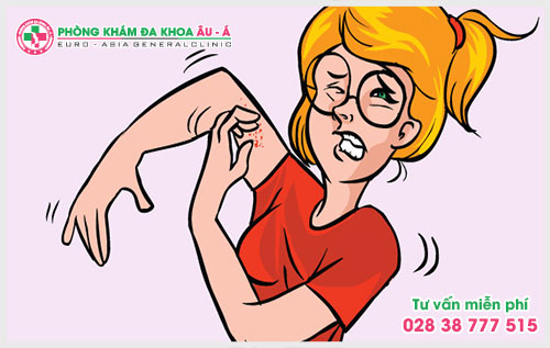  Những điều mà bạn chưa biết về bệnh ngứa tay