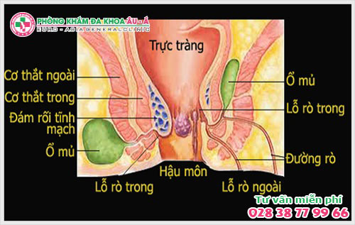  Những nguyên nhân gây nên rò hậu môn