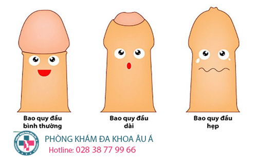  Những bệnh thường gặp ở bộ phận sinh dục nam giới
