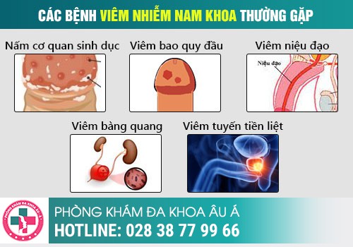  Viêm Nhiễm Nam Khoa - Hệ Lụy Khôn Lường Nếu Không Điều Trị