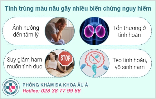Tinh trùng màu nâu là bệnh gì? Có nguy hiểm không? Tinh trùng màu nâu là bệnh gì? Có nguy hiểm không?