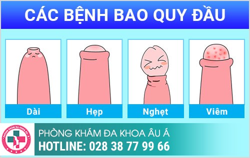  Các bệnh ngoại khoa nam Thường Gặp