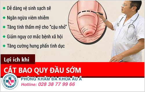 Cắt bao quy đầu mất bao nhiêu tiền Cắt bao quy đầu mất bao nhiêu tiền