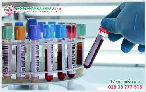  Chi phí xét nghiệm vảy nến hết bao nhiêu?