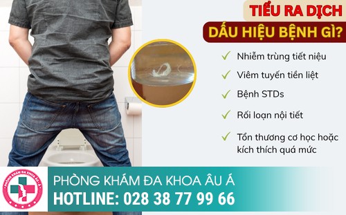  Tiểu Ra Dịch Có Phải Nhiễm Trùng Tiết Niệu Không?
