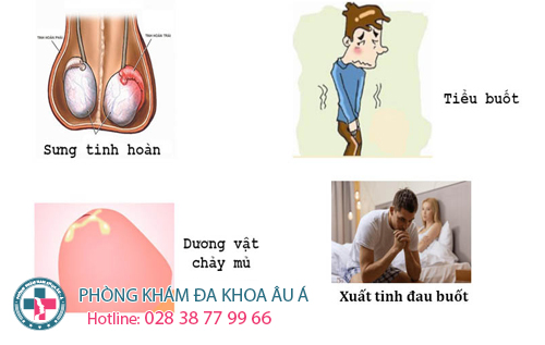  Đau dương vật sau quan hệ - dấu hiệu không nên bỏ qua