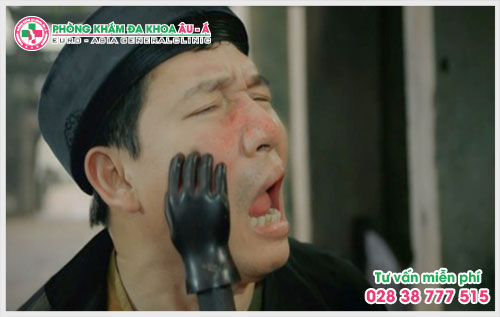  Đâu là phòng khám bệnh bệnh ngứa TPHCM chất lượng?