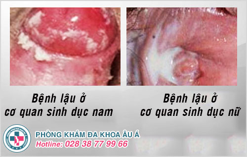 đi giải buốt đi giải buốt