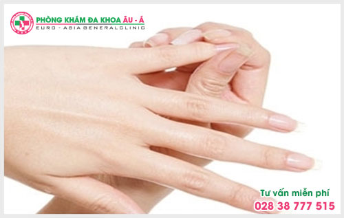  Lý do mắc bệnh chàm khô đầu ngón tay