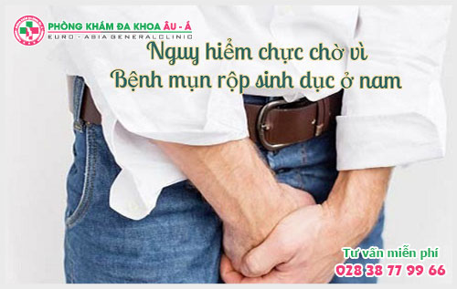  Thoát khỏi mụn rộp không quá khó với cách hỗ trợ điều trị mụn rộp sinh dục sau