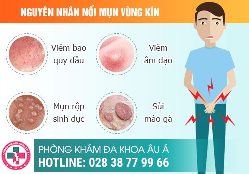  Nổi Mụn Li Ti Ở Bao Quy Đầu Là Bị Gì? Làm Sao Khắc Phục?