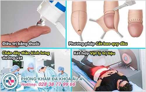 điều trị bệnh liệt dương điều trị bệnh liệt dương