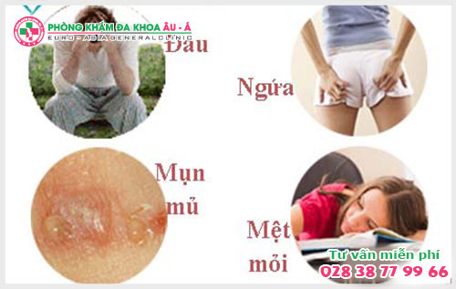  Triệu chứng và nguyên nhân của bệnh rò hậu môn