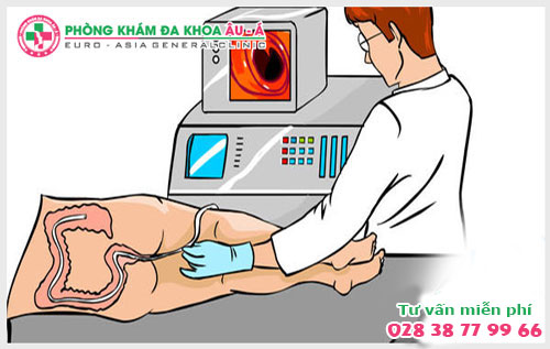  Phương pháp kiểm tra hậu môn chính xác 