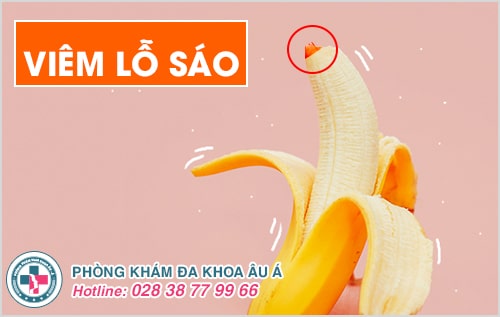  Viêm lỗ sáo là bệnh gì? Có nguy hiểm không?