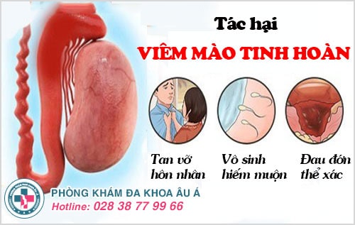viêm mào tinh hoàn viêm mào tinh hoàn