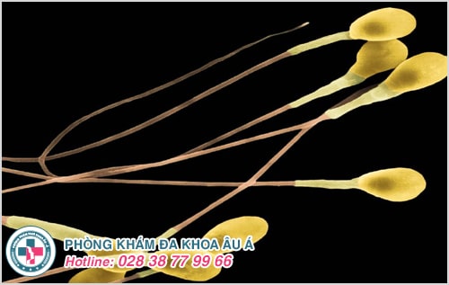  Xuất tinh màu vàng: nguyên nhân và cách điều trị